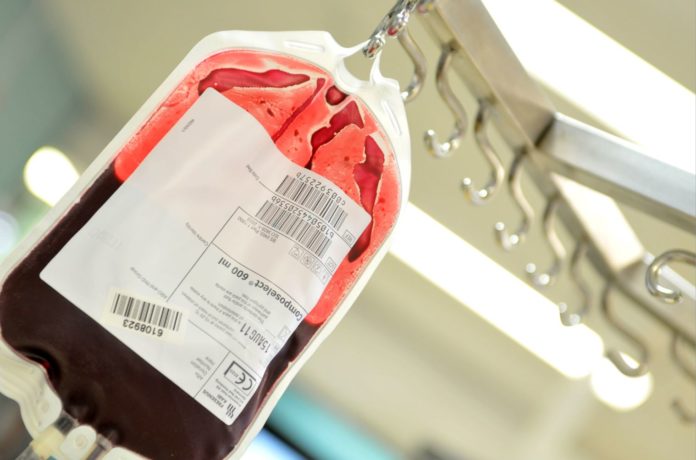 Donate now: Urgent call for blood this Easter – Bundaberg Now