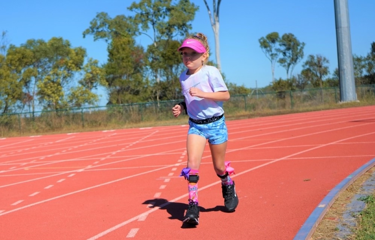 Sheer determination in every step for Hallee – Bundaberg Now