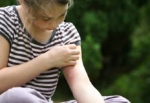 Girl looking at mosquito bit on her arm